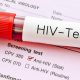 Kasus HIV/AIDS di Tulungagung Meningkat, Dewan desak Pemkab Laksanakan Perda 