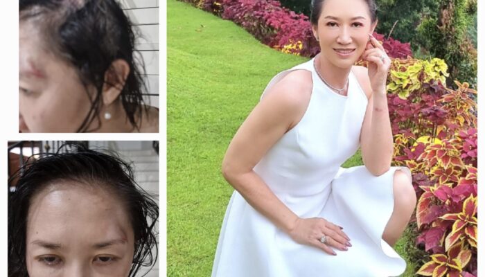 Sherly Chebing Bangkit dari Trauma, Menjadi Suara bagi Korban Kekerasan  Surabaya